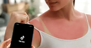 “Burn lines” : c’est quoi cette tendance qui pousse les ados à mettre en danger leur peau ?