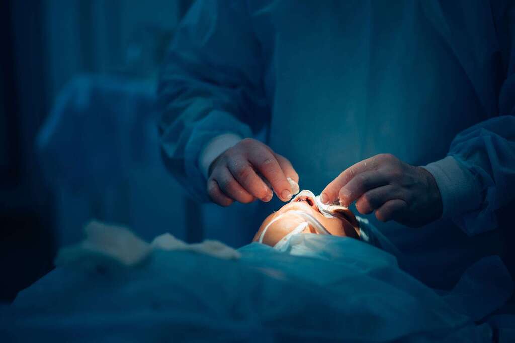 Comment réparer un nez gravement cassé ou raté par une chirurgie esthétique ?