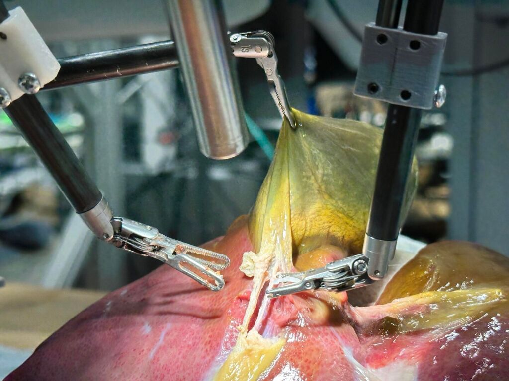 Présenté à Strasbourg, un robot chirurgical réalise une opération en complète autonomie