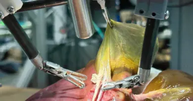 Présenté à Strasbourg, un robot chirurgical réalise une opération en complète autonomie