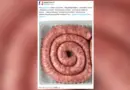 Rappel de produit : attention cette viande de porc ne doit plus être consommée
