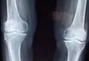 Santé