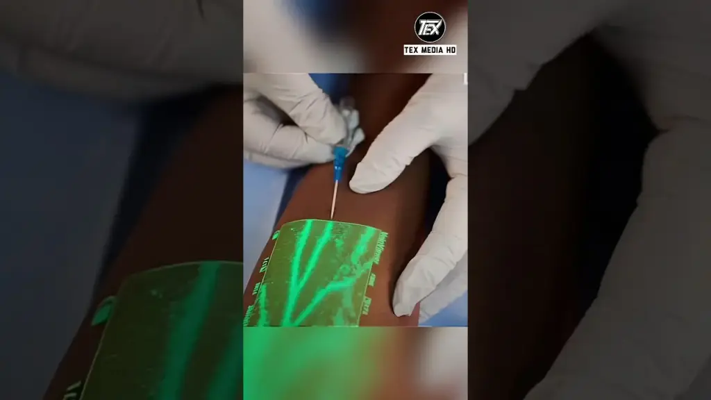 Visionneuse de veines la Nouvelle technologie Médicale 2025.