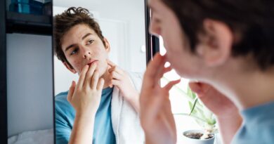 Acné : l’Agence européenne du médicament approuve un traitement novateur pour les adolescents - A la une - Destination Santé