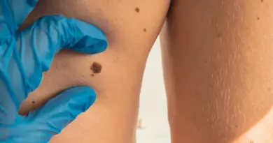 Acné, mélanome, eczéma : la télé-expertise dermatologique bouscule les parcours de soins