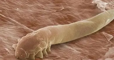 Cette minuscule créature vit dans votre corps et vous n'imaginez pas ce qu'elle peut provoquer