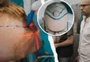 Greffe de cheveux: 80 Suisses convergent vers cette clinique chaque année