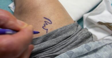 Il est passé de 1,75 m à 1,85 m : un homme subit une chirurgie d’allongement des membres pour gagner 10 cm
