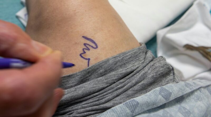 Il est passé de 1,75 m à 1,85 m : un homme subit une chirurgie d’allongement des membres pour gagner 10 cm