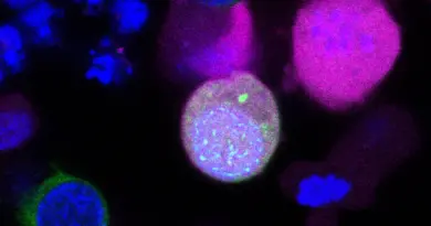 Lab-grown stem cells initiate key steps of human egg and sperm formation