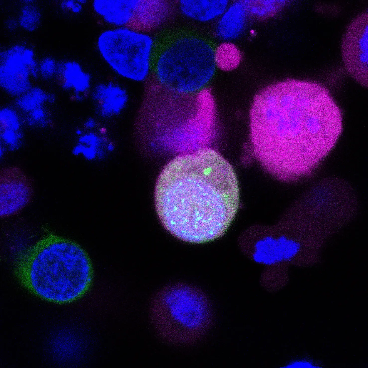 Lab-grown stem cells initiate key steps of human egg and sperm formation