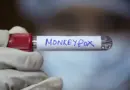 Le Sénégal prend des mesures contre la variole du singe après un cas détecté à Dakar - RTBF Actus
