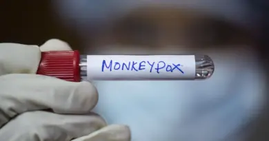 Le Sénégal prend des mesures contre la variole du singe après un cas détecté à Dakar - RTBF Actus