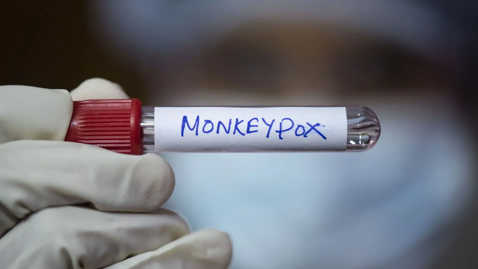 Le Sénégal prend des mesures contre la variole du singe après un cas détecté à Dakar - RTBF Actus
