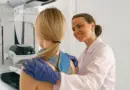 Prévention du cancer, dépistages, hygiène de vie : les gestes clés pour éviter 4 cancers sur 10