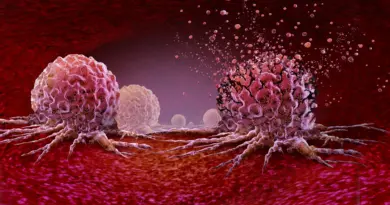 The 30-minute workout that could slash cancer cell growth by 30%