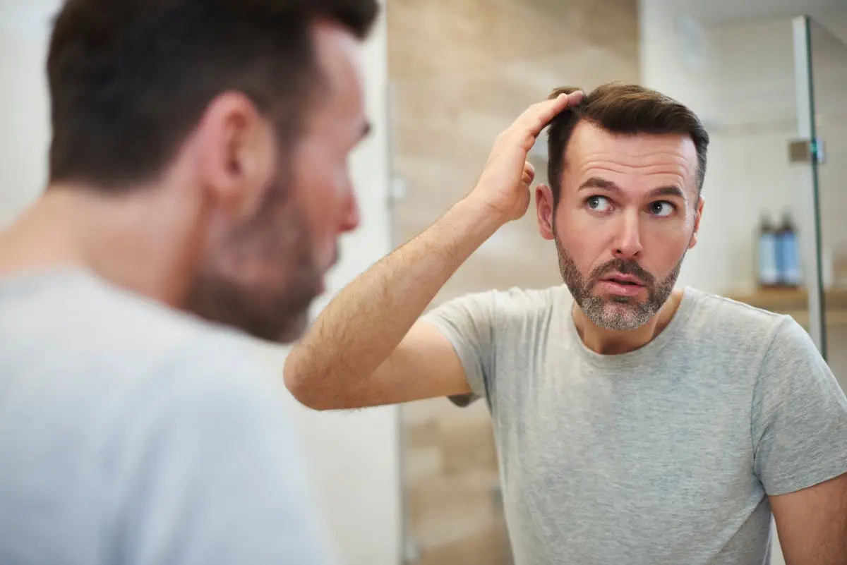 Voici pourquoi votre consommation de sucre pourrait aggraver la chute de cheveux
