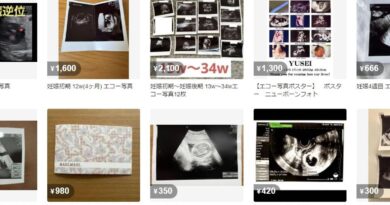 Au Japon, le business juteux et inavouable des photos d’échographies