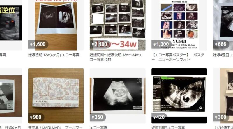 Au Japon, le business juteux et inavouable des photos d’échographies