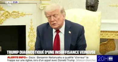 Donald Trump est-il malade ?