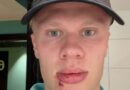 Drôle de blessure pour Erling Haaland avec la Norvège: “Je me suis fait attaquer par la porte du bus”