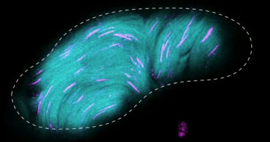 Here’s how fruit flies' giant sperm squeeze into tight spaces