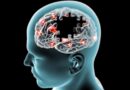 Maladie de Parkinson : le côté atteint prédit l’évolution de la maladie