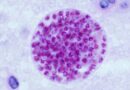 Toxoplasmose : un tandem de biomarqueurs pour diagnostiquer les infections chroniques · Inserm, La science pour la santé