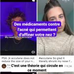 Des médicaments contre l&rsquo;acné révèlent des effets secondaires sur la forme du nez.