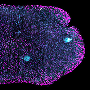 Trichoplax, organisme sans muscles ni neurones, coordonne ses mouvements de manière surprenante.
