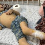 Gaza : les hôpitaux manquent de matériel médical essentiel, situation critique.