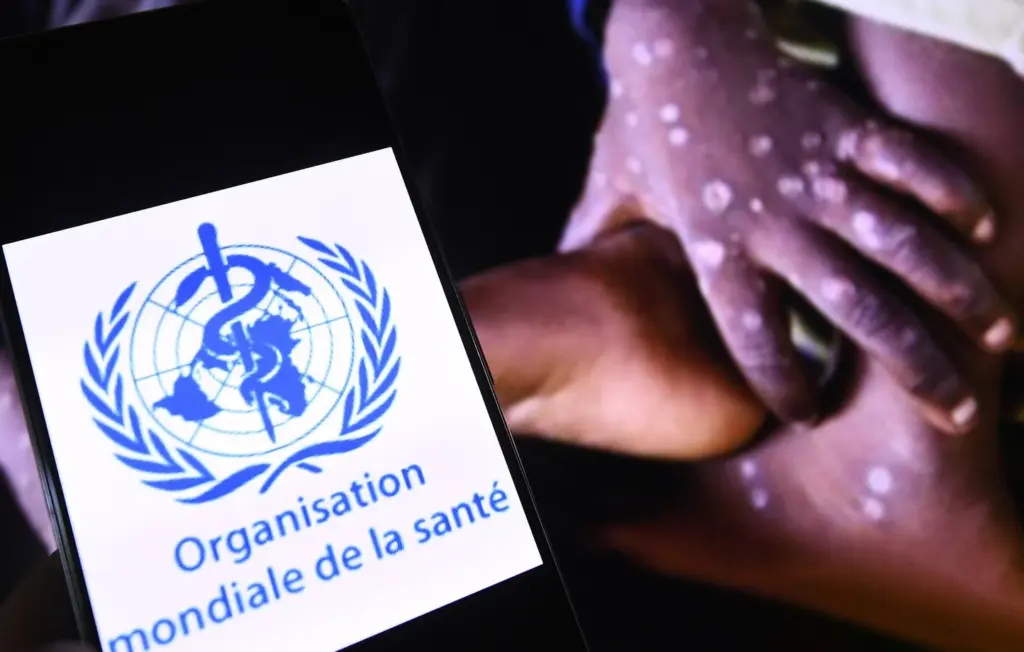 Les critiques des complotistes envers l’Organisation mondiale de la santé expliquées.