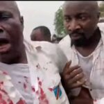 Martin Fayulu blessé lors d&rsquo;un rassemblement de l&rsquo;opposition à Kinshasa.