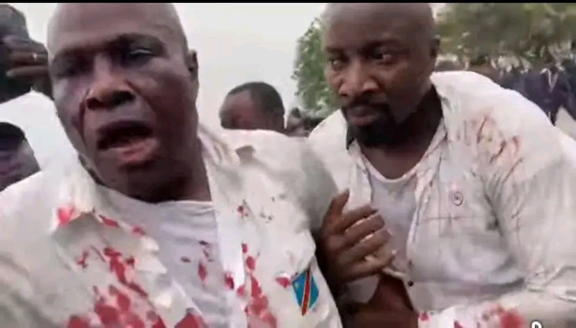Martin Fayulu blessé lors d’un rassemblement de l’opposition à Kinshasa.