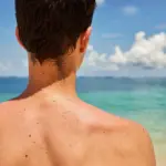 Les grains de beauté : composition et caractéristiques selon des experts dermatologues.