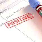 État actuel de l&rsquo;épidémie de sida : traitements disponibles et avancées de recherche.