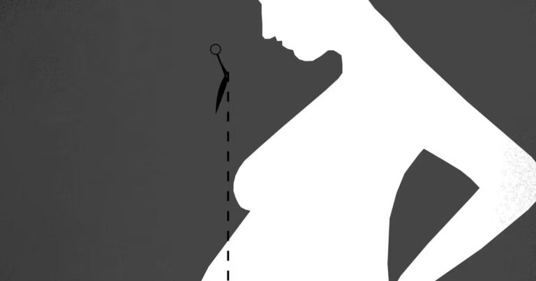La « pregorexie » : un risque pour la santé des femmes enceintes en France