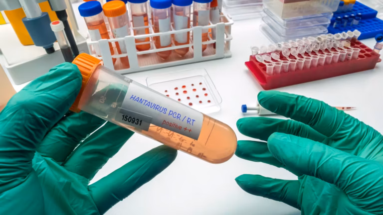 Nouveau cas de hantavirus signalé au Royaume-Uni, un mois après l’alerte mondiale.