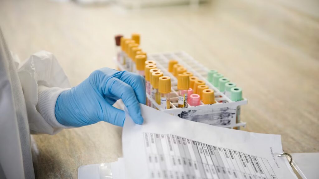 Remboursement des tests de dépistage au cadmium : critères d’éligibilité à connaître.