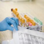 Remboursement des tests de dépistage au cadmium : critères d’éligibilité à connaître.