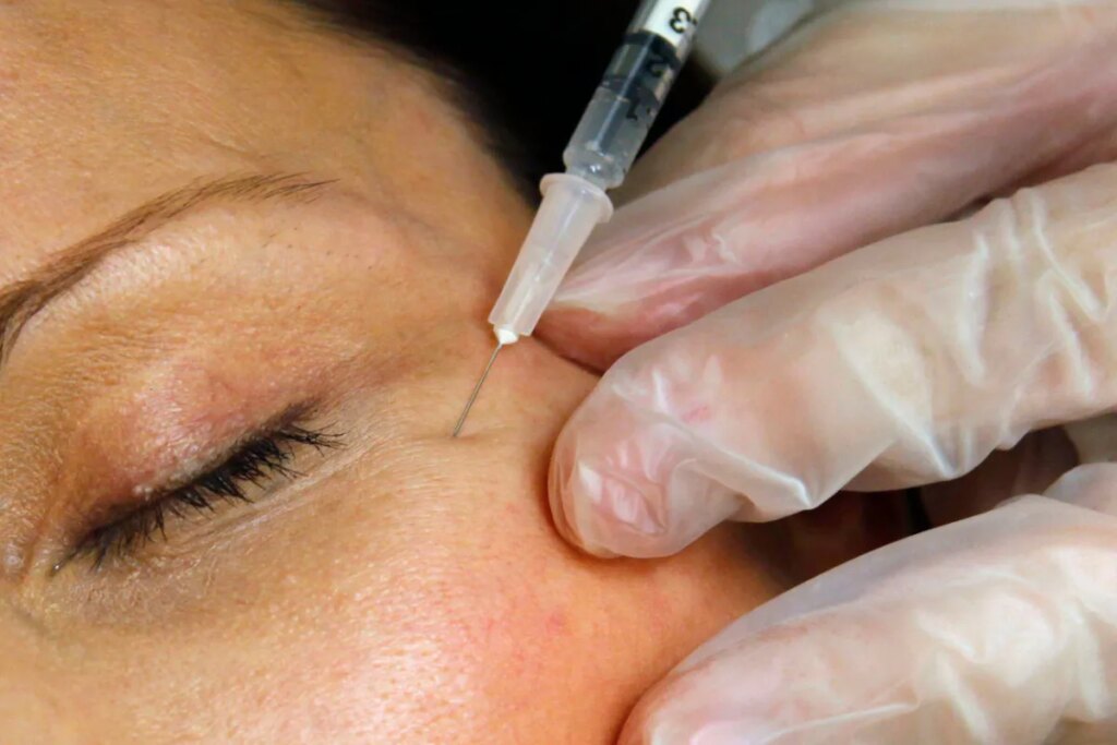 Injections esthétiques illégales en plein essor : victimes signalent des conséquences graves.