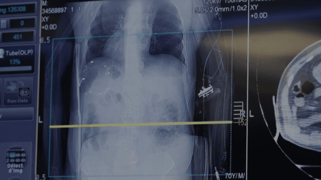 L’intelligence artificielle et le risque de chômage pour les médecins en France