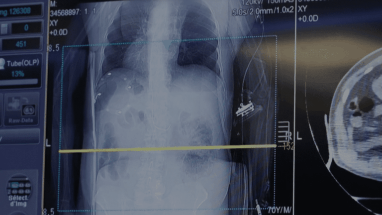 L’intelligence artificielle et le risque de chômage pour les médecins en France