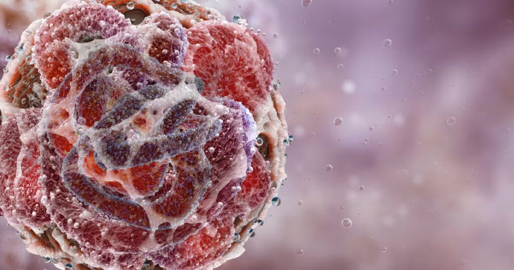 Cancer du pancréas : avancées de la recherche chinoise au congrès américain sur le cancer.