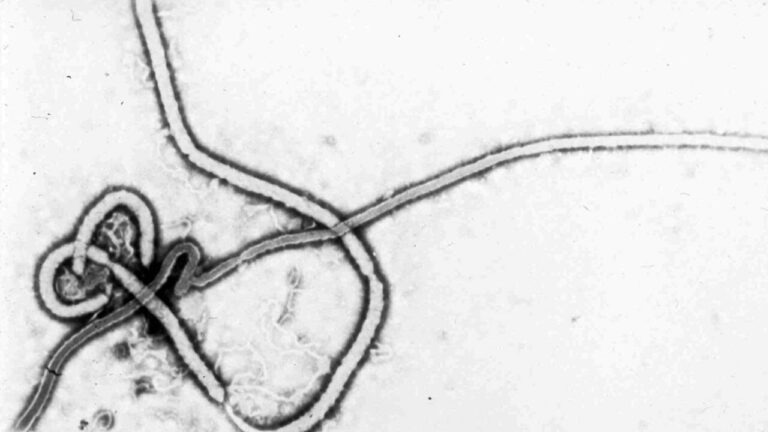 Ebola : un médecin de retour de RD Congo testé positif en France.