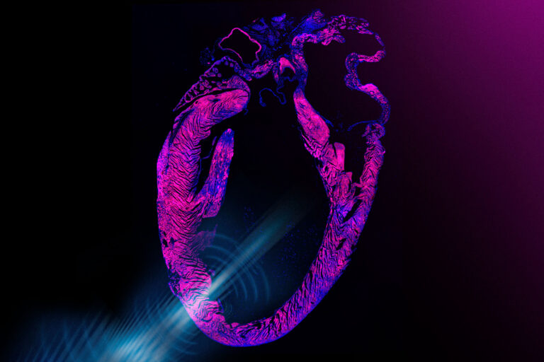 Un pacemaker basé sur ultrasons stabilise le rythme cardiaque sans intervention invasive