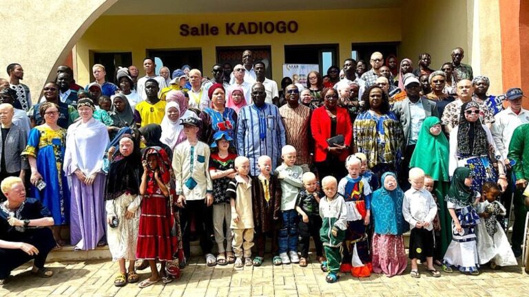 ALBIWEEK au Burkina Faso : sensibilisation sur l’albinisme et lutte contre les préjugés.