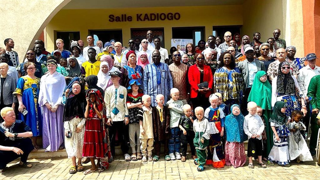 ALBIWEEK au Burkina Faso : sensibilisation sur l’albinisme et lutte contre les préjugés.