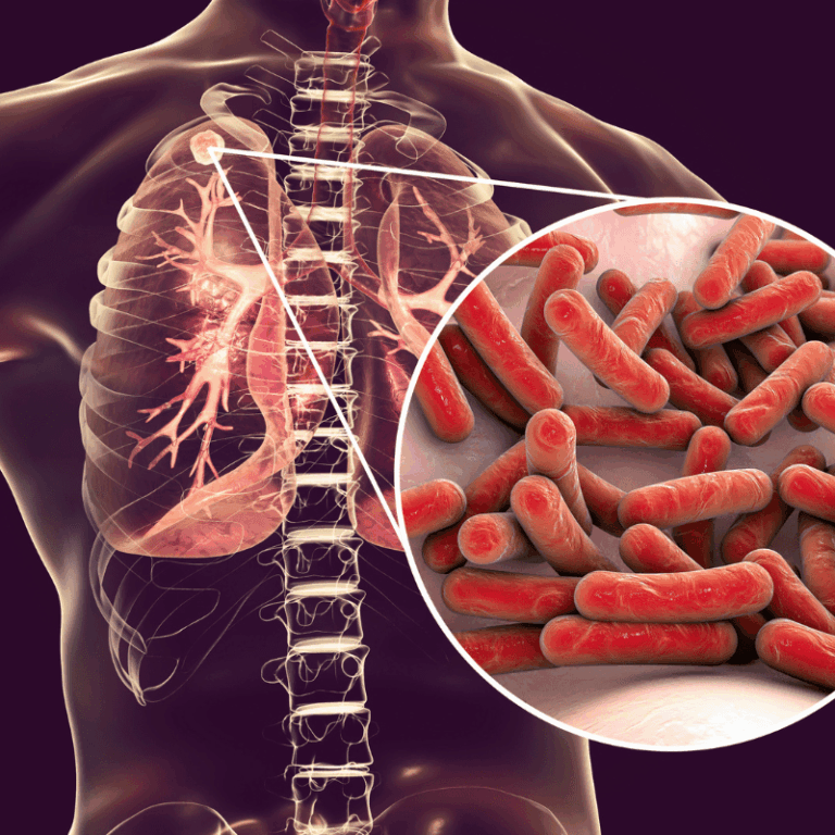 Une nouvelle cible thérapeutique contre la tuberculose identifiée par des équipes de Lille