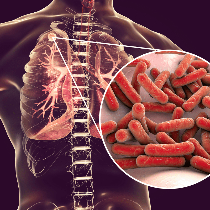 Une nouvelle cible thérapeutique contre la tuberculose identifiée par des équipes de Lille